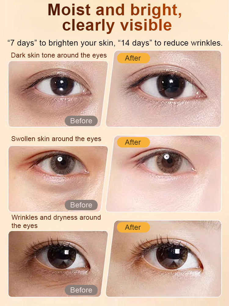 Once you apply our anti-wrinkle serum, your wrinkles will instantly vanish✨ It's more effective than twenty facial treatments🎇 Today, we're offering a factory price special—get two for the price of a single meal🎁