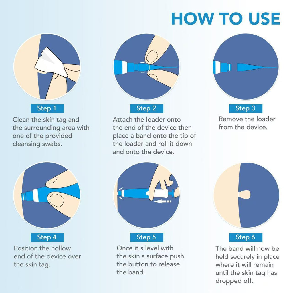 Auto Skin Tag Remover Kit for Face & Body