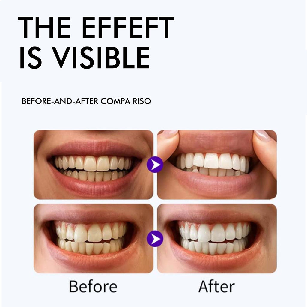 Purple Whitening Strips