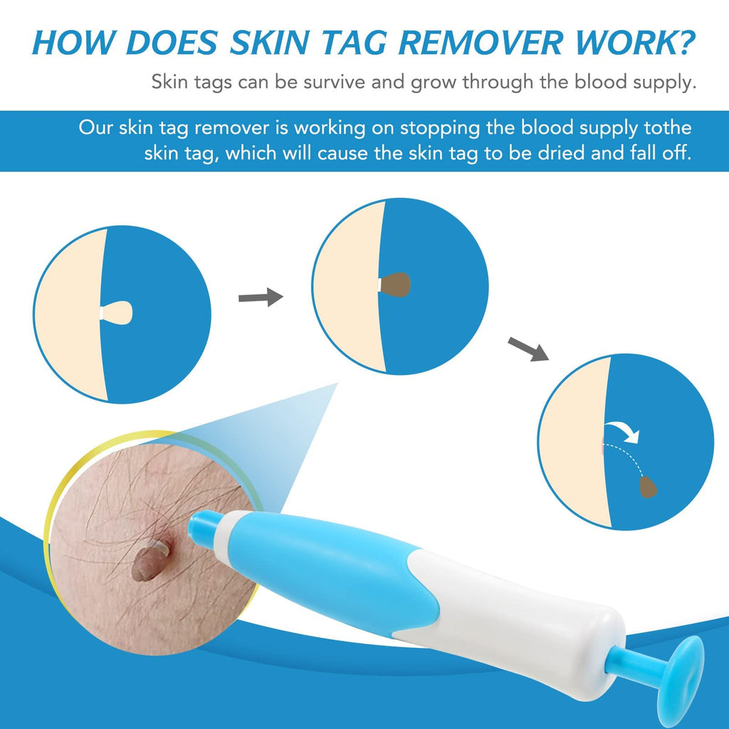 Auto Skin Tag Remover Kit for Face & Body