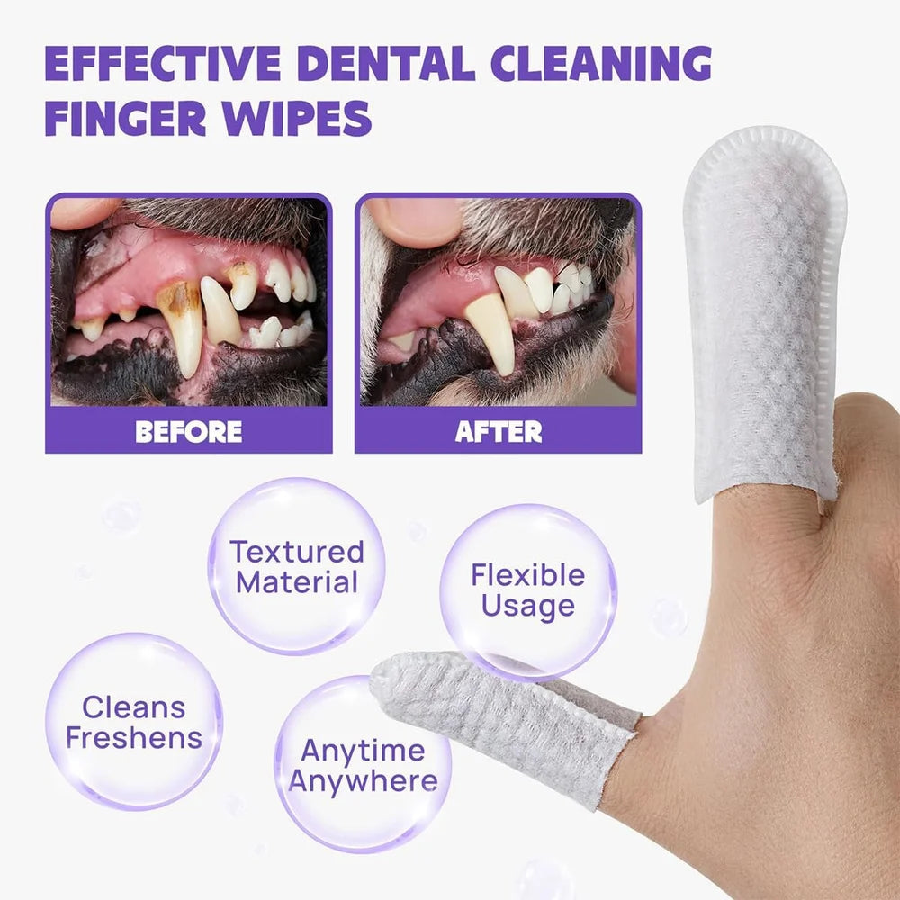 Pet Dental Finger Wipes for Dogs and Cats, 50 Count, Teeth Cleaning and Plaque Control