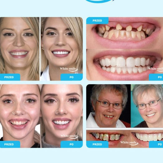 ADAPTABLE TEETH SET FOR A PERFECT SMILE