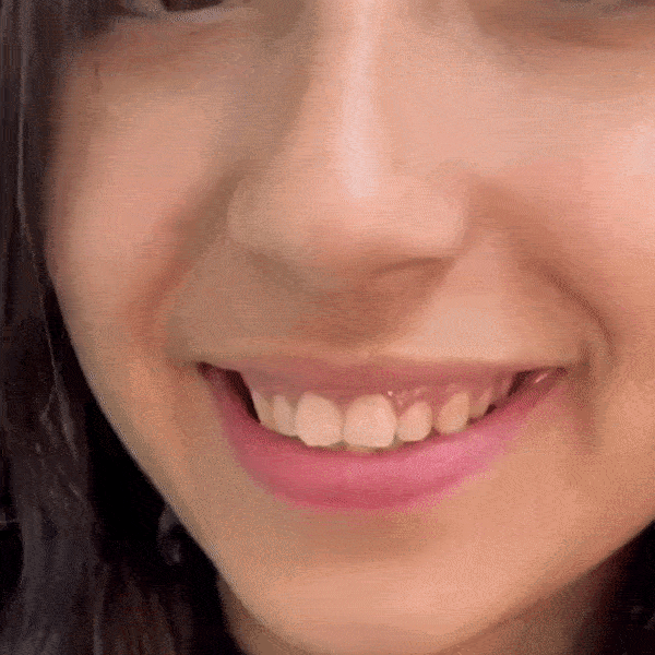 ADAPTABLE TEETH SET FOR A PERFECT SMILE